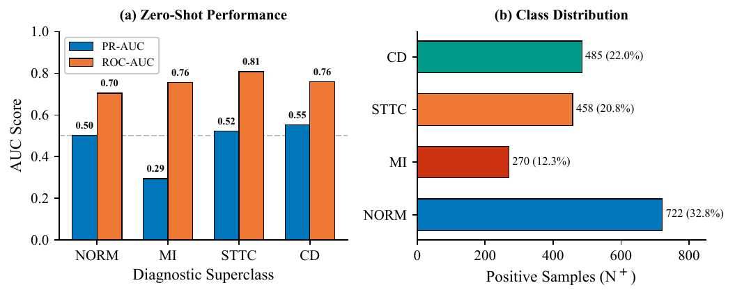 ECG-RAMBA — Zero-Shot ECG Generalization Across Hospitals - Image 4