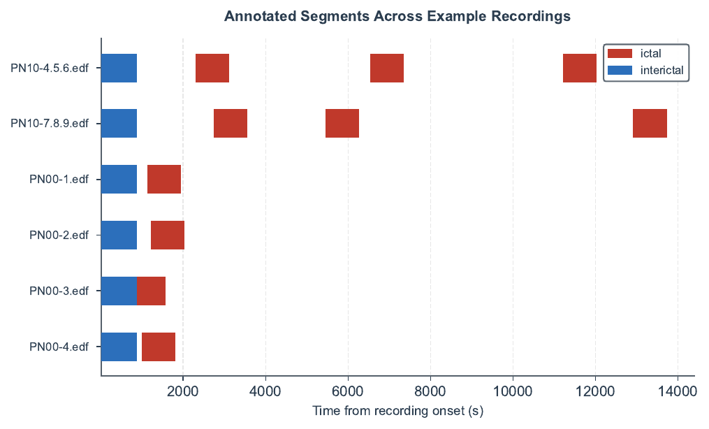 EEG2Text — Clinical EEG Annotation & Auto-Report Platform - Image 7